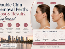 Double Chin Removal Perth: Cost & Results Explained Double Chin Removal Perth: Cost & Results Explained