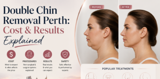 Double Chin Removal Perth: Cost & Results Explained Double Chin Removal Perth: Cost & Results Explained