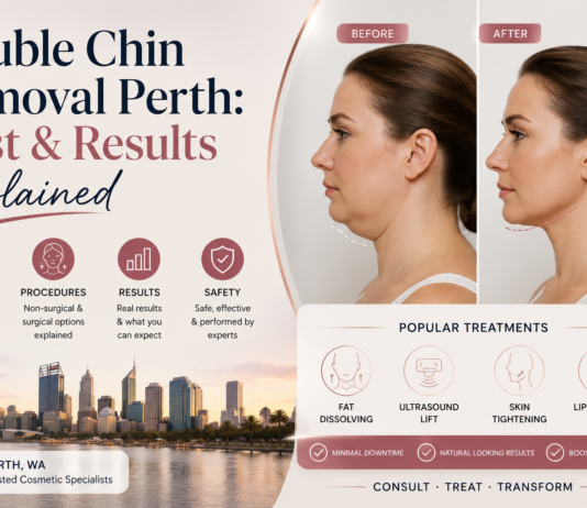 Double Chin Removal Perth: Cost & Results Explained Double Chin Removal Perth: Cost & Results Explained