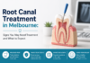 Root Canal Treatment in Melbourne: Signs You May Need Treatment and What to Expect Root Canal Treatment in Melbourne