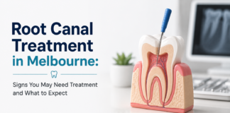 Root Canal Treatment in Melbourne: Signs You May Need Treatment and What to Expect Root Canal Treatment in Melbourne