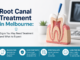 Root Canal Treatment in Melbourne: Signs You May Need Treatment and What to Expect Root Canal Treatment in Melbourne