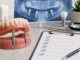 7 Recall Checks for a Ball-Retained Implant Overdenture Ball-Retained Implant Overdenture