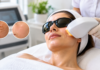 Say Goodbye to Sun Damage with Advanced IPL Photofacials Sun Damage with Advanced IPL Photofacials