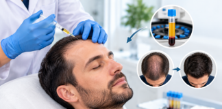 Thinning Hair Solutions With PRP Thinning Hair Solutions With PRP