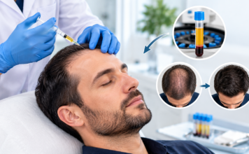 Thinning Hair Solutions With PRP Thinning Hair Solutions With PRP